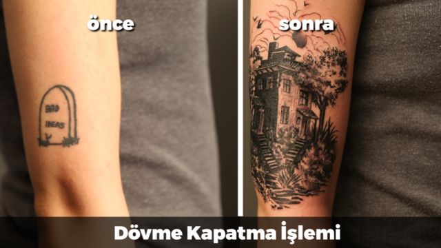Dovme Kapatma Islemi Videolu Anlatim Mynet Kadin Tv